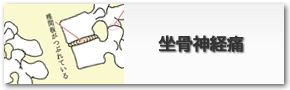 坐骨神経痛