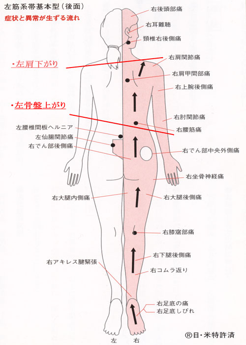 腰 の 痛み 後ろ 左