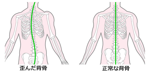 sebonebaransu610.jpg