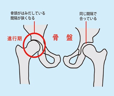 股関節