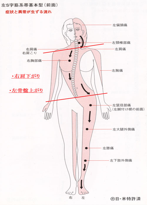 左S字筋系帯前