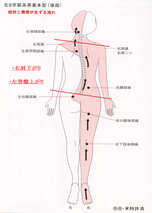 左S字筋系帯後