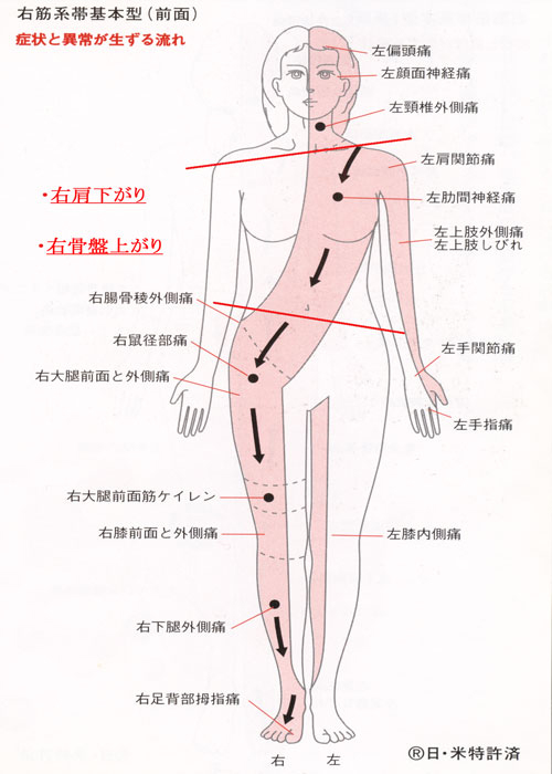 右筋系帯前