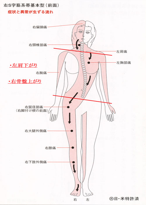 右Ｓ字筋系帯前