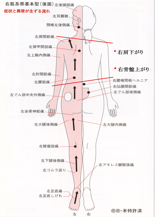 右筋系帯後ろ