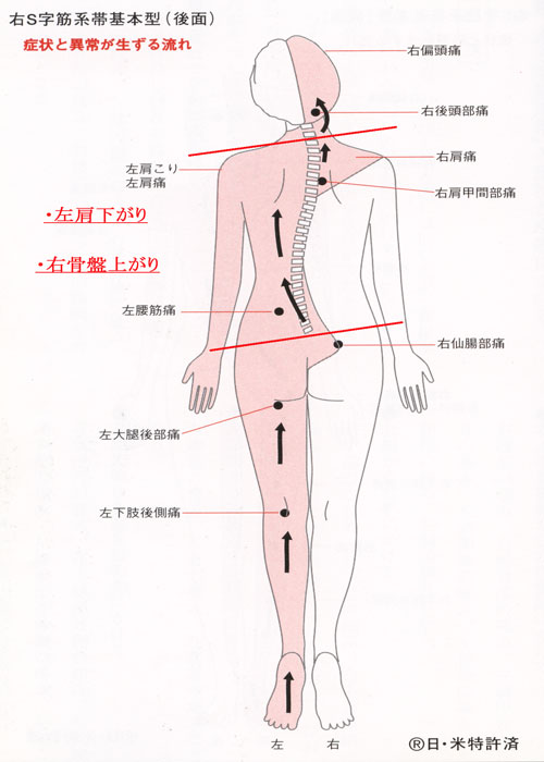 右Ｓ字筋系帯後